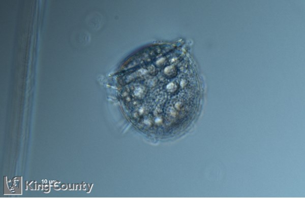 Photo of Dinophysis rotundata